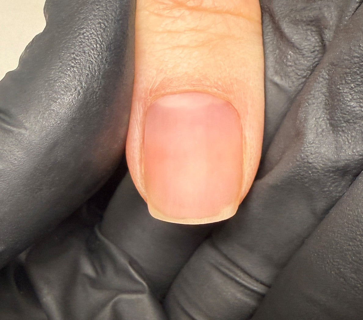 След 1 седмица